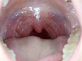 300人のおくち 第1集　サンプル画像08